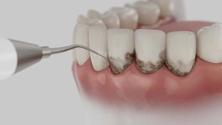 Trusted Wisdom Tooth Removal service in Hagan, GA - Dentist Open Now